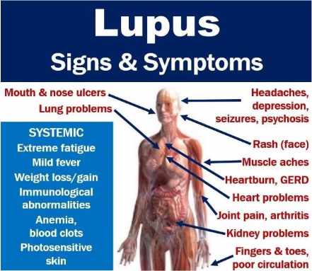 lupus